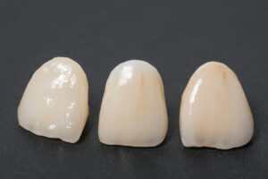 保険適用で歯を白くした症例