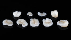 たくさんの詰め物がおかれている