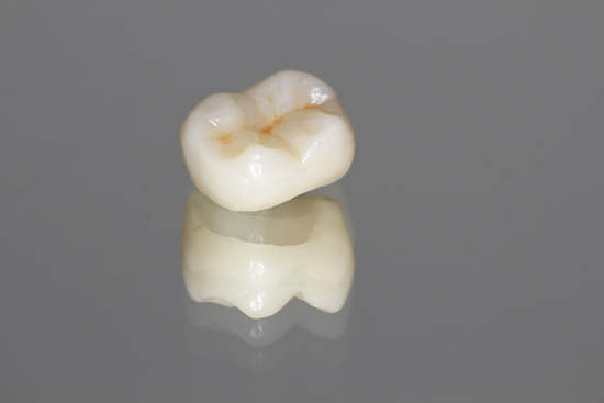 ジルコニアの歯