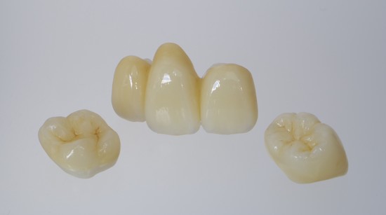 ガルバニー電流対策でセラミックに変える