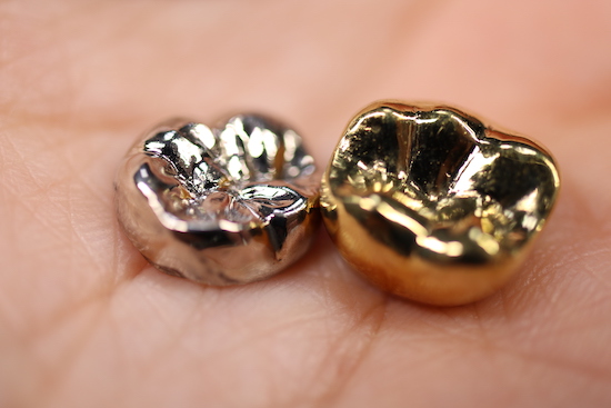 ガルバニー電流が起こるイメージ