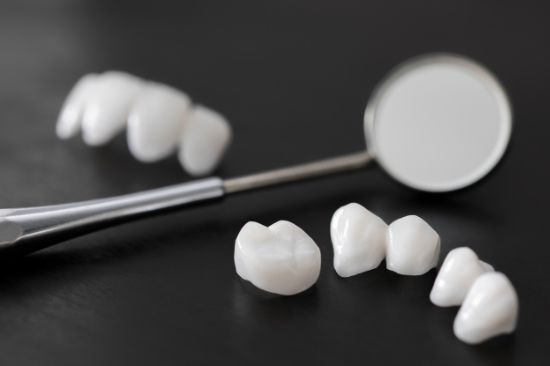 セラミックの歯