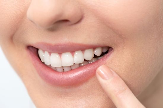 セラミック治療を受けた女性