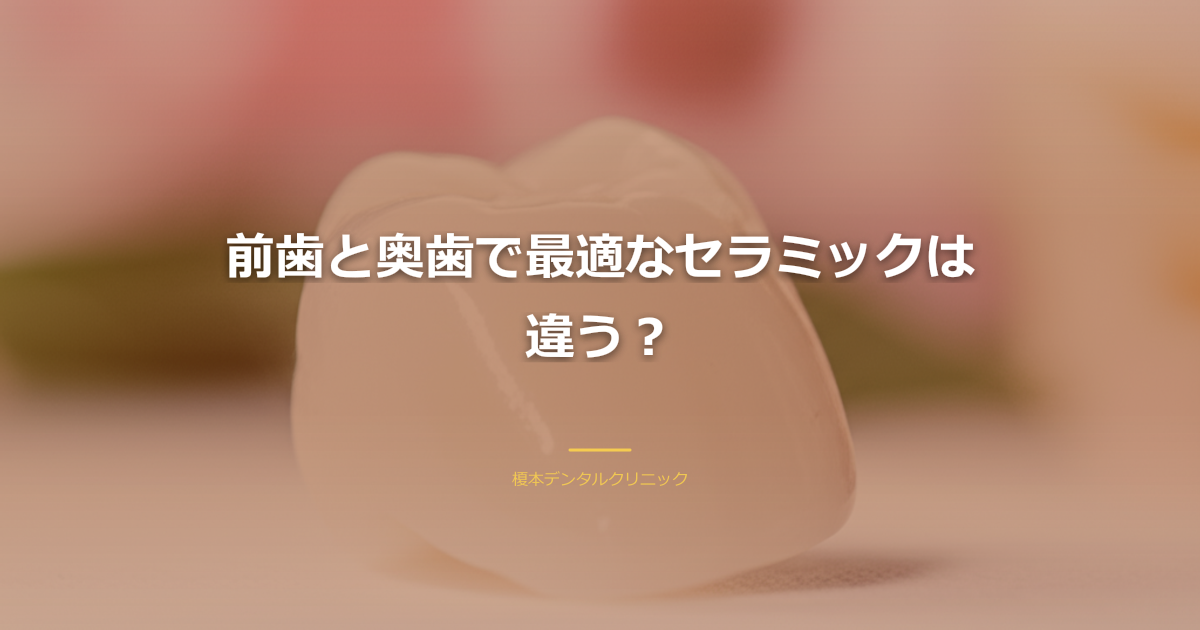 歯の部位とセラミック