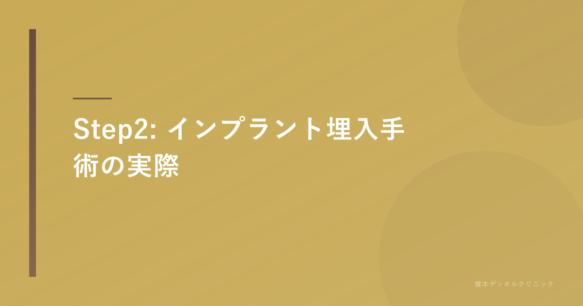 インプラント埋入手術の様子