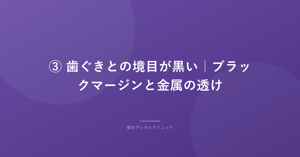 ③ 歯ぐきとの境目が黒い|ブラックマージンと金属の透け