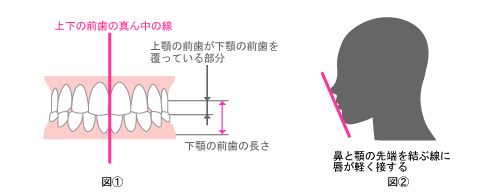 ふじみ野駅1分の歯科医院　榎本デンタルクリニック　矯正歯科　キレイな歯並びとは