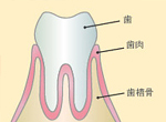 ふじみ野駅1分の歯科医院　榎本デンタルクリニック　歯周病治療　歯周病の進行状態